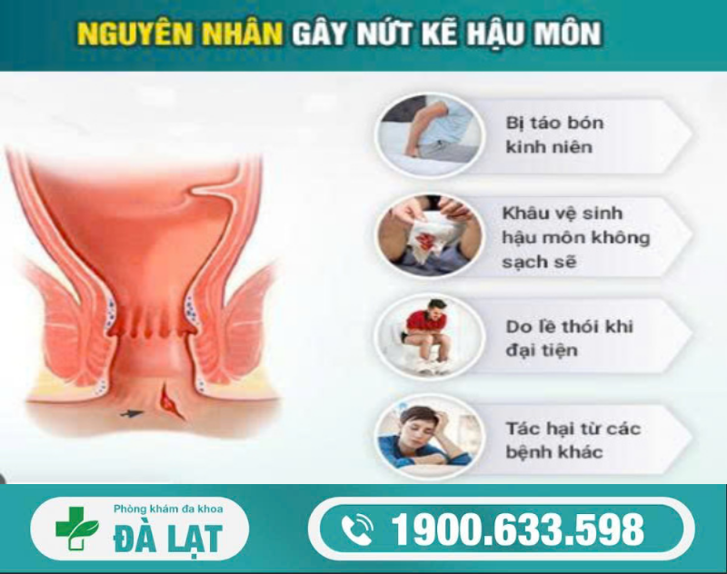 Hình ảnh minh họa